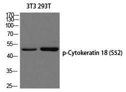 Anti-KRT18 Polyclonal Antibody 4