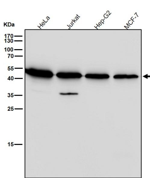 Anti-CXCR5 Antibody (1U955)