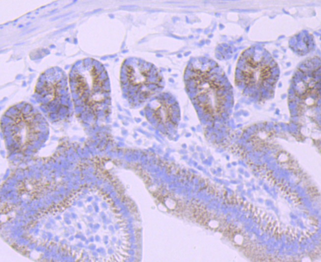Anti-CPS1 Antibody (3F443)