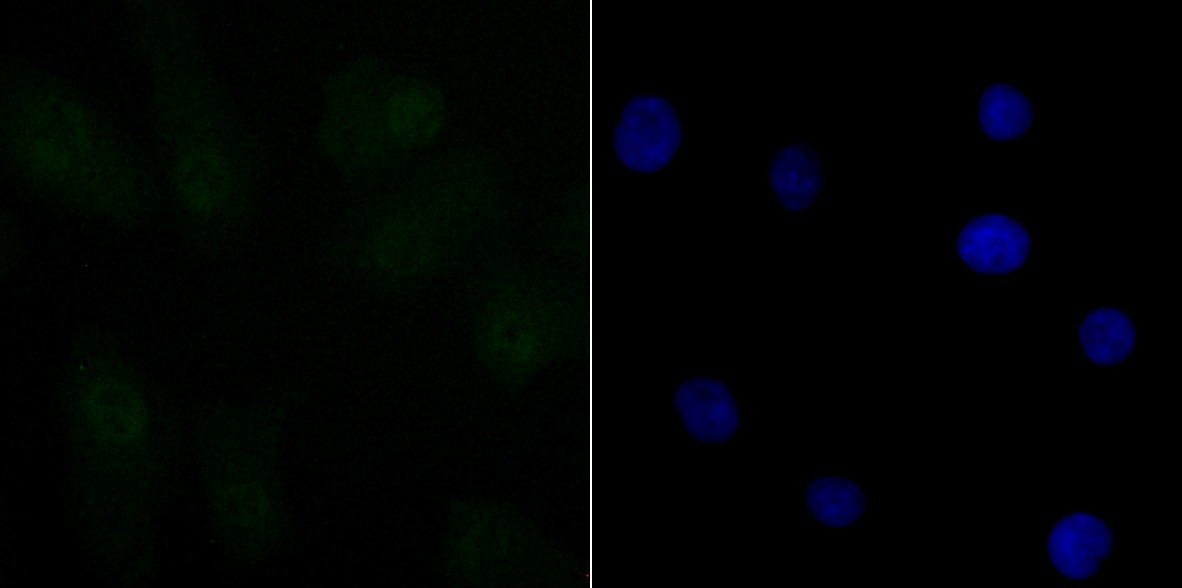 Anti-CtBP1 Antibody (2M770)