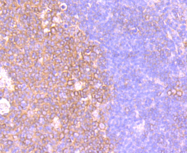 Anti-CXCR5 Antibody (1U955)
