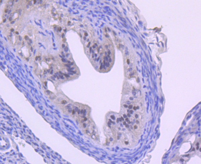 Anti-Cullin 1 Antibody (2P159)