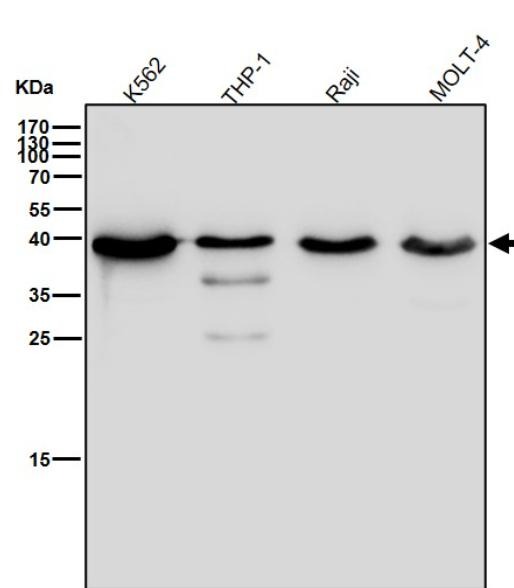 Anti-CXCR5 Antibody (1U955)