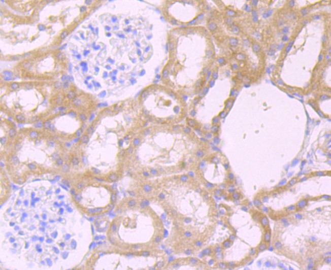 Anti-CXCR5 Antibody (1U955)