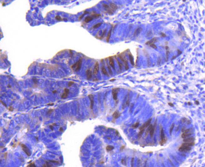 Anti-Cyclin A2 Antibody (9J817)