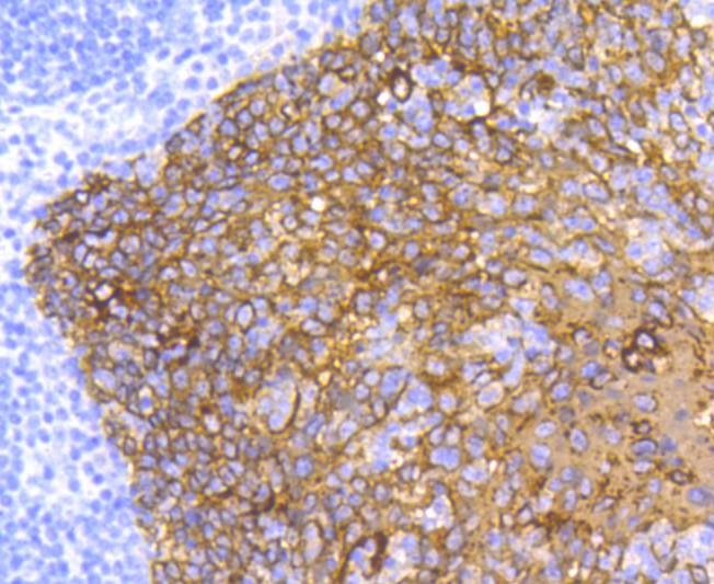 Anti-KRT5 Antibody (6F446)