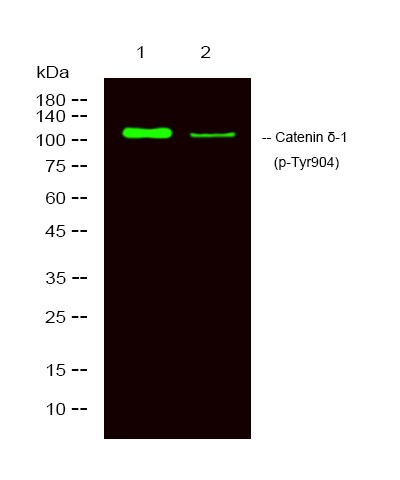Anti-Phospho-CTNND1 (Tyr904) Polyclonal Antibody