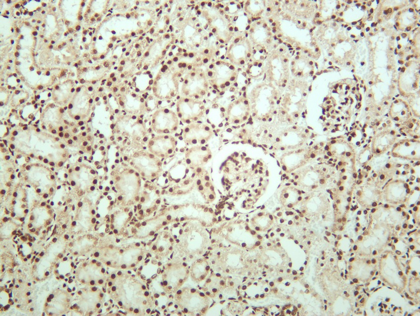Anti-CTCF Antibody (5J799)