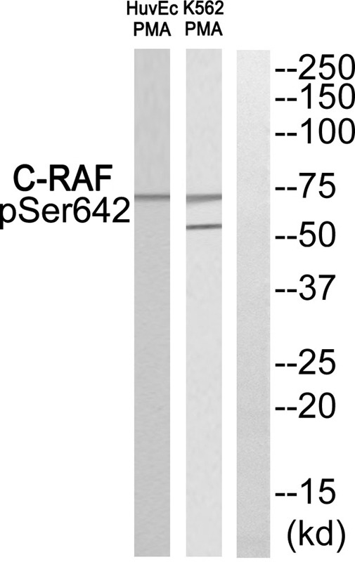 Anti-Phospho-RAF1 (Ser642) Polyclonal Antibody 2
