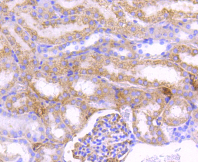 Anti-CPT2 Antibody (3I417)