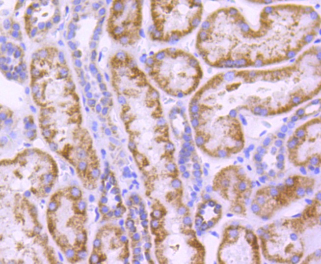 Anti-CPT2 Antibody (3I417)