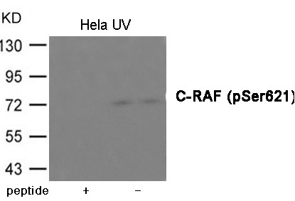 Anti-Phospho-RAF1 (Ser621) Polyclonal Antibody