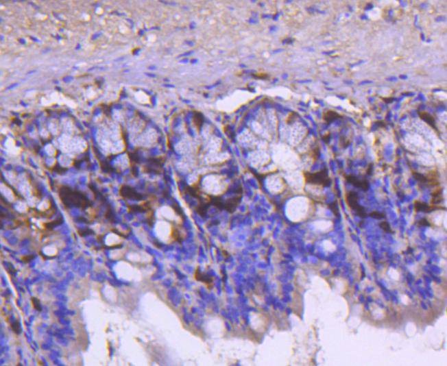 Anti-Cyclin A2 Antibody (9J817)