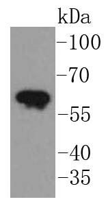 Anti-KRT5 Antibody (6F446)
