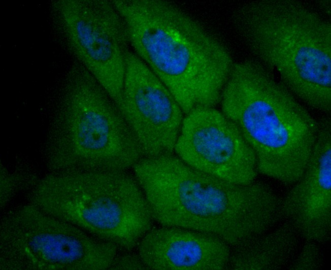 Anti-CXCR3 Antibody (8K493)