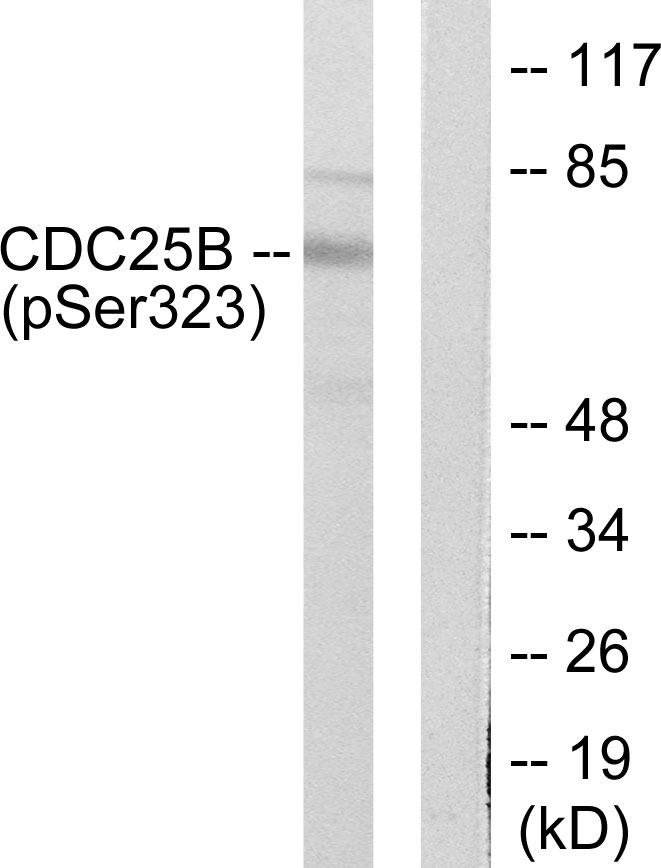 Anti-Phospho-CDC25B (Ser323) Polyclonal Antibody