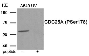 Anti-Phospho-CDC25A (Ser178) Polyclonal Antibody