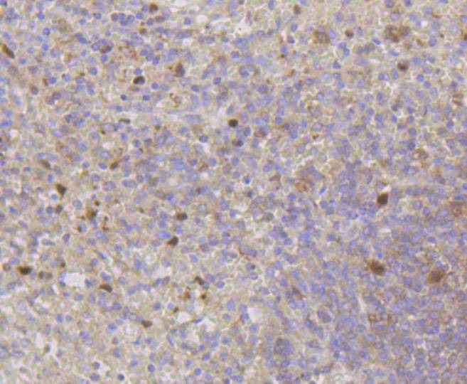 Anti-CDK2 Antibody (3L593)