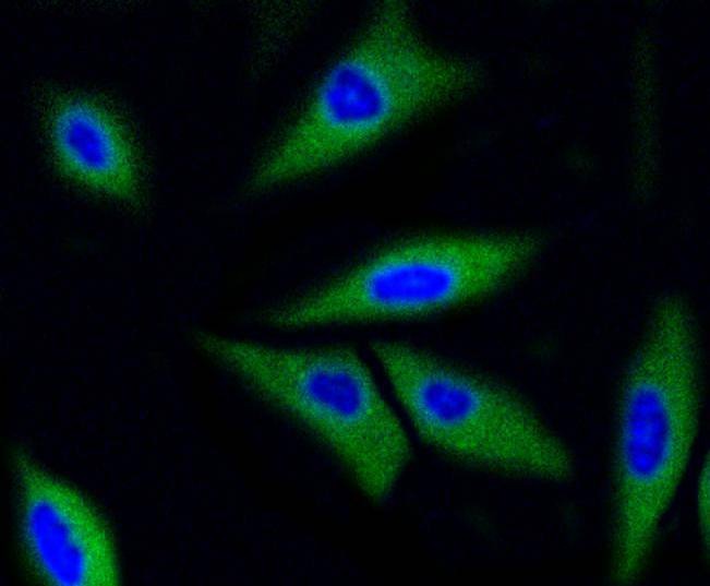 Anti-CDK2 Antibody (3L593)