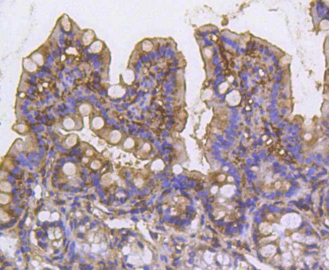 Anti-Cortactin Antibody (9I917)