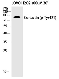 Anti-Phospho-Cortactin (Tyr421) Polyclonal Antibody