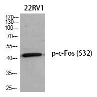 Anti-Phospho-FOS (Ser32) Polyclonal Antibody