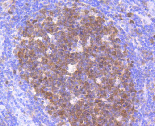 Anti-CDK2 Antibody (3L593)
