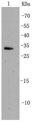 Anti-CDK5 Antibody (8M152)