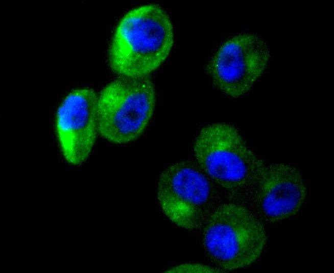 Anti-Cortactin Antibody (9I917)
