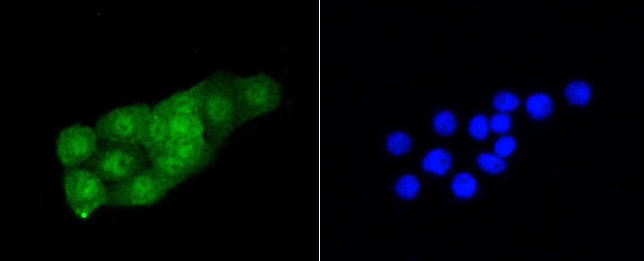 Anti-CDK2 Antibody (3L593)
