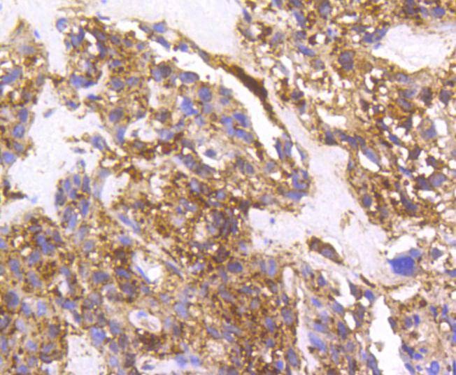 Anti-Cortactin Antibody (9I917)