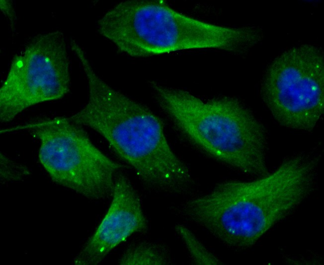 Anti-Cellular Apoptosis Susceptibility Antibody (8O505)