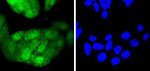 Anti-CDK4 Antibody (1F732)