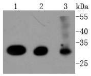 Anti-CDK4 Antibody (5A439)