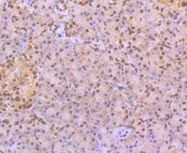Anti-CELF1 Antibody (3Z245)