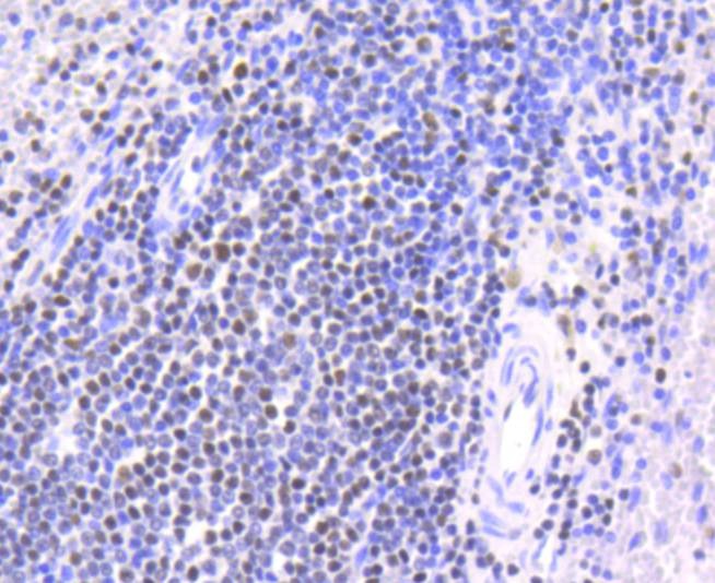 Anti-CHEK2 Antibody (3L509)