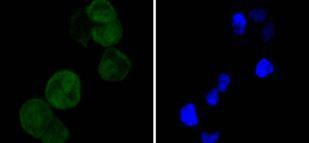 Anti-CDK4 Antibody (5A439)