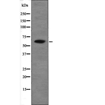 Anti-Phospho-CHEK2 (Thr26, Ser28) Polyclonal Antibody