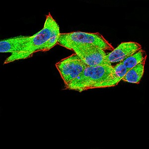 Anti-CFHR5 Antibody (9M883)
