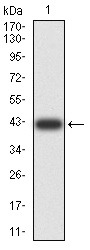 Anti-CDH11 Antibody (6T438)