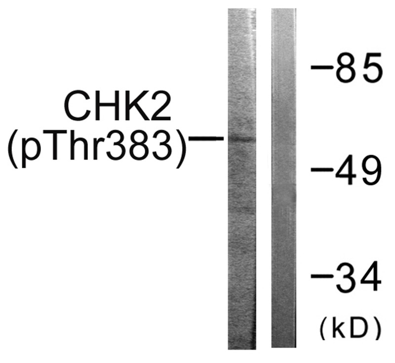 Anti-Phospho-CHEK2 (Thr383) Polyclonal Antibody