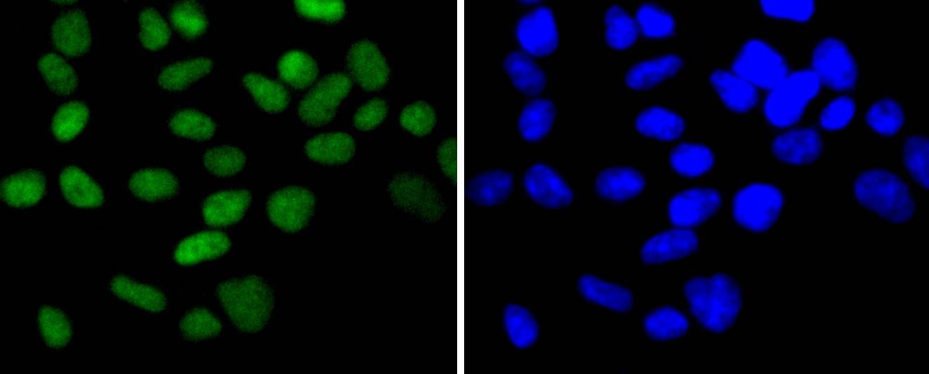 Anti-CHEK2 Antibody (3L509)