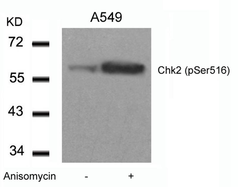 Anti-Phospho-CHEK2 (Ser516) Polyclonal Antibody