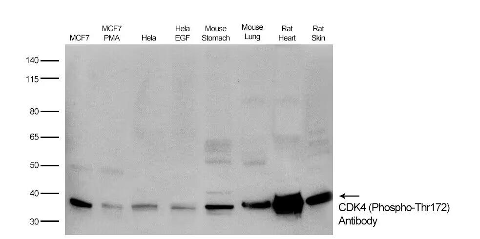Anti-Phospho-CDK4 (Thr172) Polyclonal Antibody
