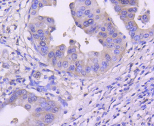 Anti-CDK4 Antibody (1F732)