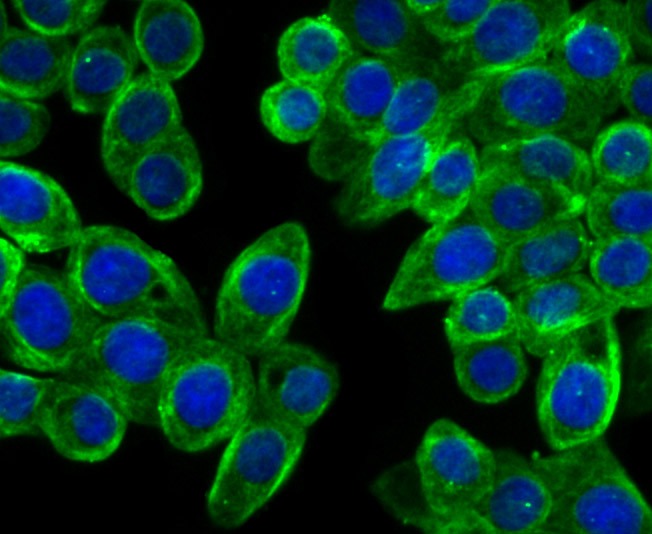 Anti-Cellular Apoptosis Susceptibility Antibody (8O505)