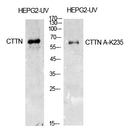 Anti-Acetyl-Cortactin (Lys235) Polyclonal Antibody