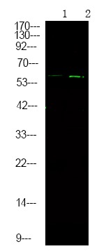Anti-Phospho-CHEK2 (Ser379) Polyclonal Antibody