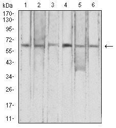 Anti-CFHR5 Antibody (9M883)