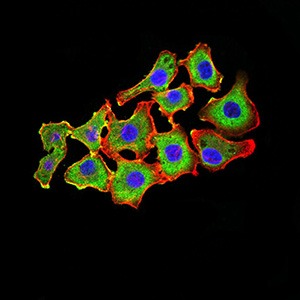 Anti-CDH11 Antibody (6T438)